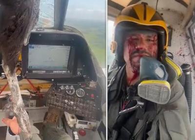 چهره غرق در خون خلبان پس از برخورد یک پرنده به هواپیما